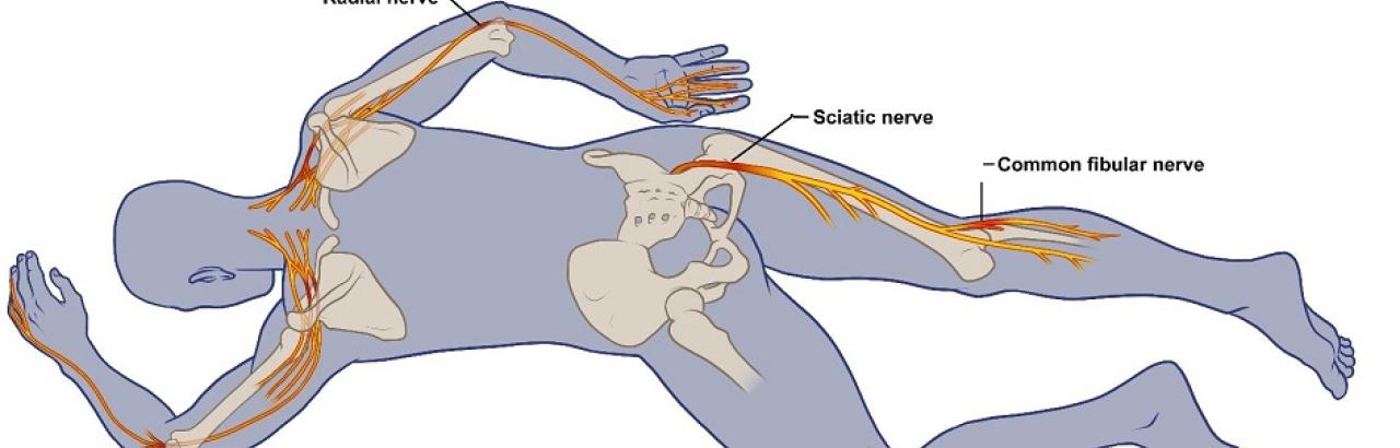 Post-COVID-19 Nerve Damage Rehabilitation Highlighted In NYT